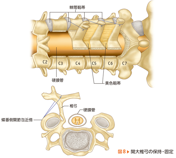 整形外科レジデントのための脊椎のベーシック手術【電子版付】 – 日本